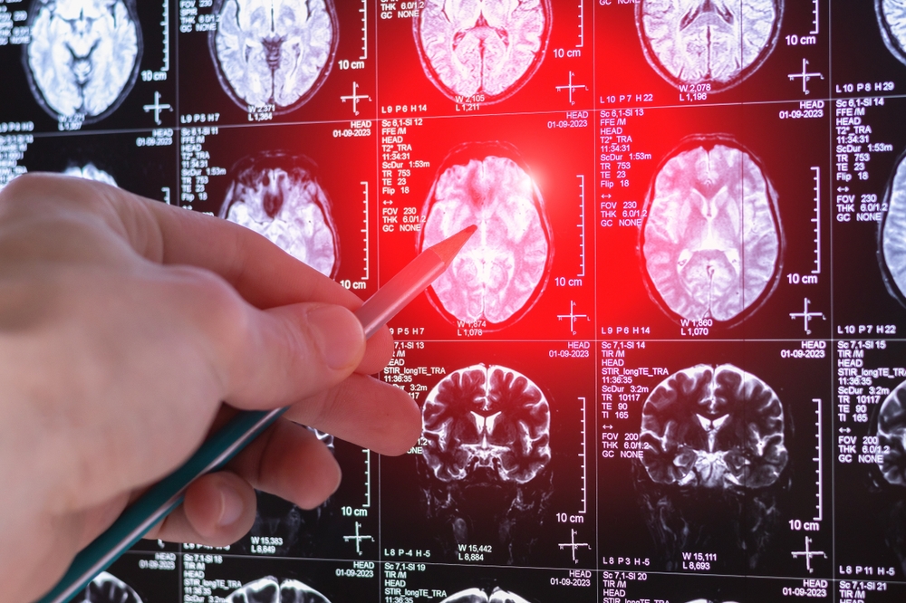 brain scan