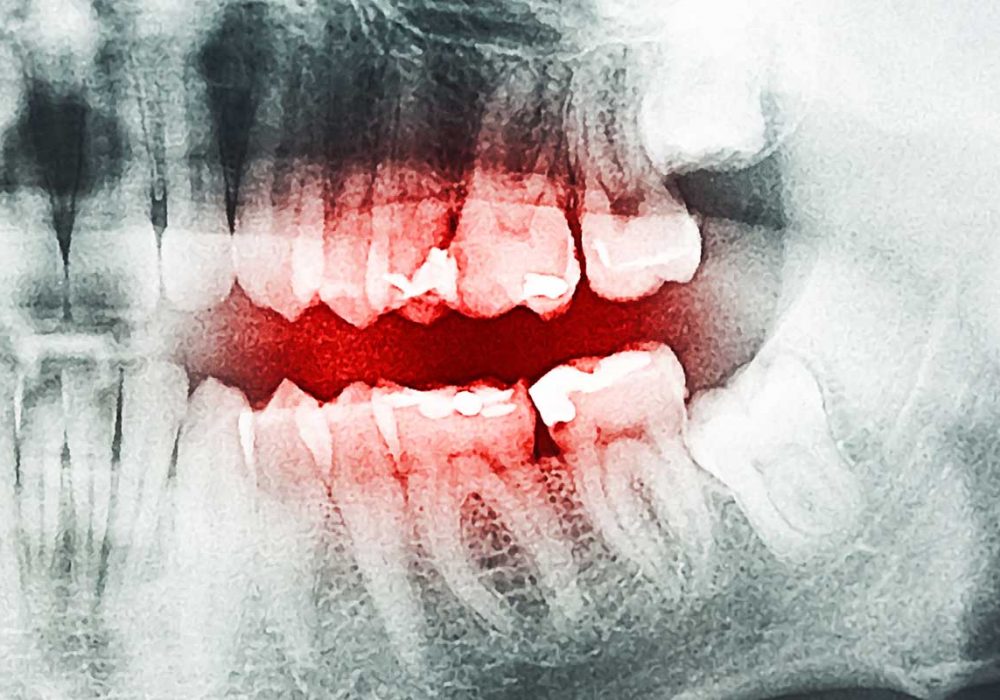 SLB2_0014_shutterstock_231350419