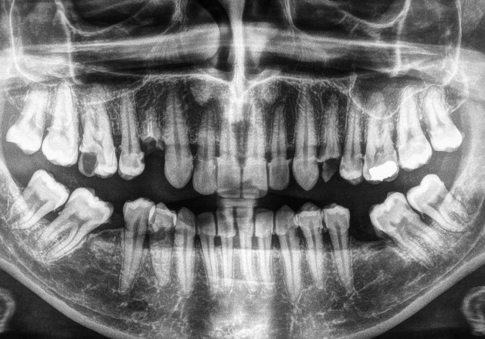 SLB_0042_shutterstock_400671556