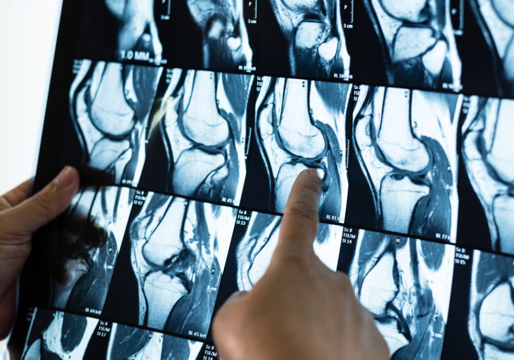 Woman,Doctor,Hand,Holding,And,Pointing,Patient,Bone,X-ray,Film