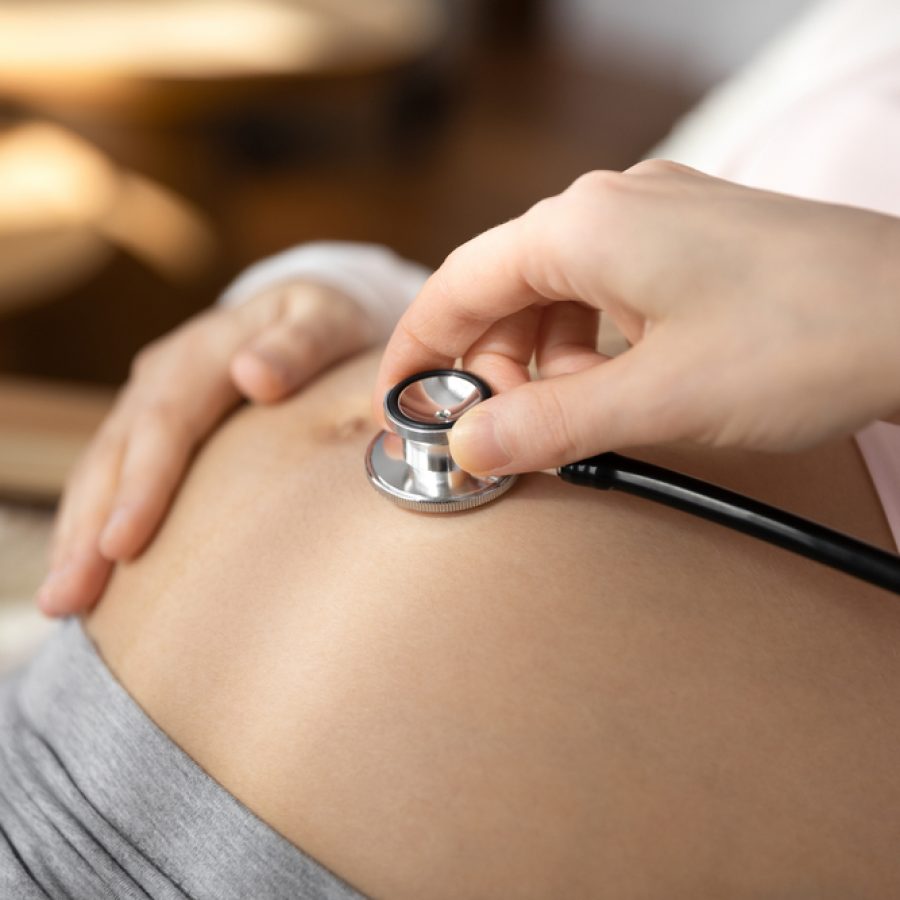 obstetric negligence