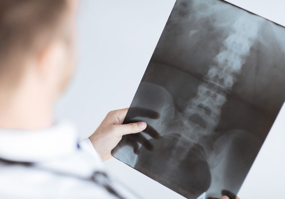 Close,Up,Of,Male,Doctor,Holding,X-ray,Or,Roentgen,Image