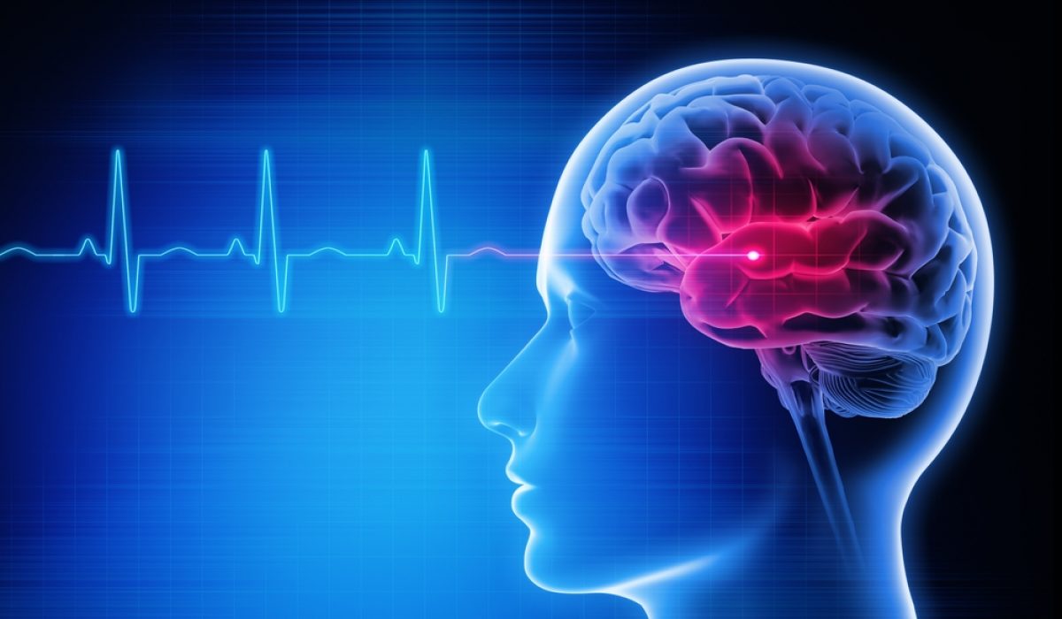 Medical,3d,Illustration,Of,A,Man,With,Stroke,Symptoms