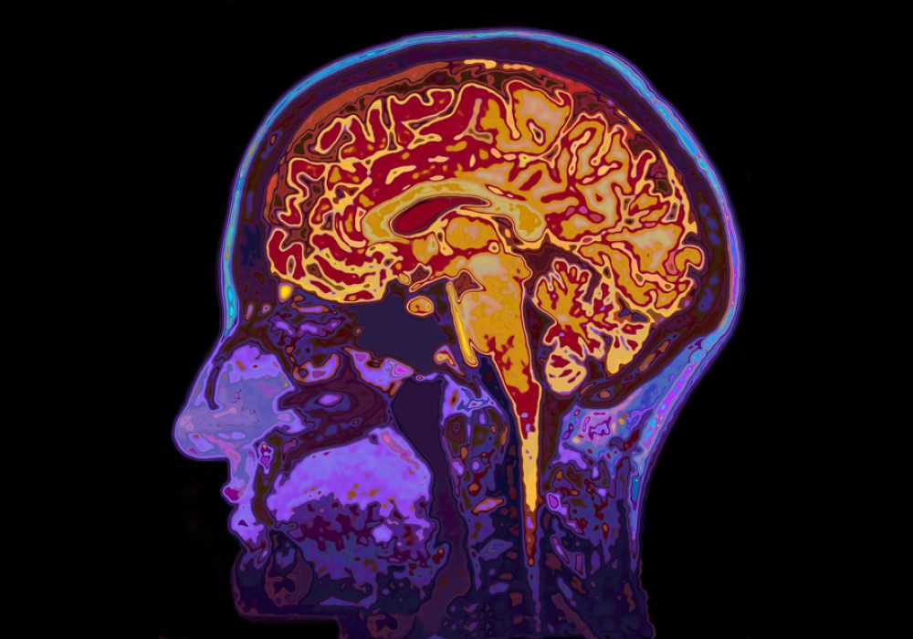 Mri,Image,Of,Head,Showing,Brain